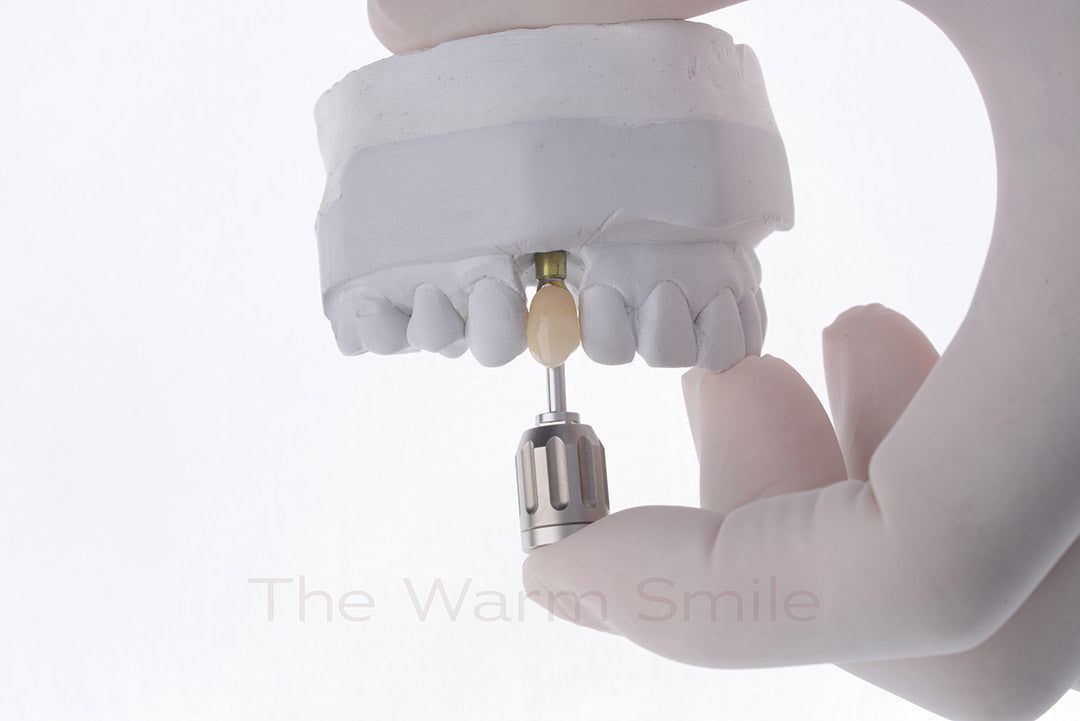 Advantages of Dental Implants - The Warm Smile, Melbourne